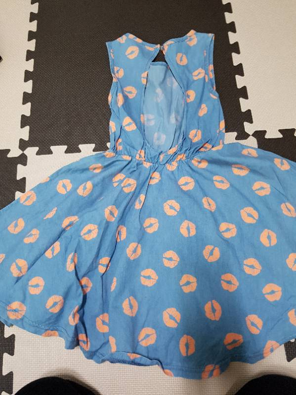 #육아왕 여아 여름 원피스 이미지